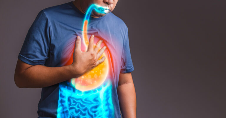 Esofagitis por reflujo: causas, síntomas y tratamientos